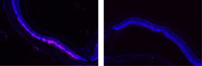 Retina with and without POD GDNF Nanoparticles Treatment