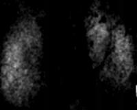 Neuronal Activation Patterns in the Olfactory Bulb