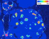 Different Cells inside An Islet of Langerhans within the Pancreas