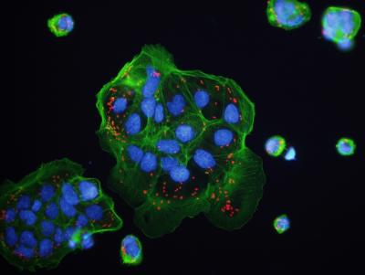 Bacteria in the Host Cell