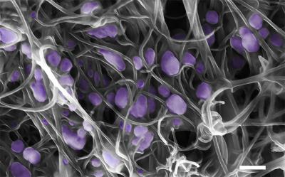 New, Carbon-Nanotube Tool for Ultra-Sensitive Virus Detection and Identification (2 of 3)