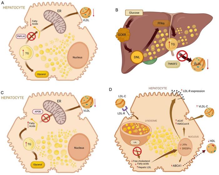 Pathogenesis of fatty liver according to various etiologies