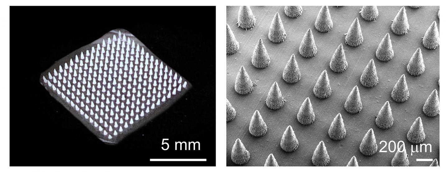 Microneedle Patch