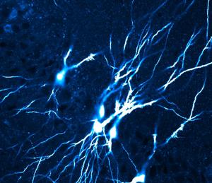 Network of interconnected CA3 pyramidal neurons (mature mice)