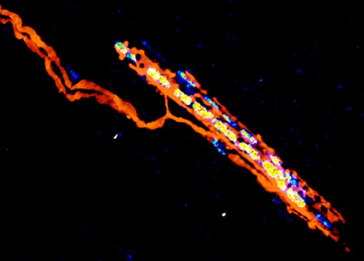Muscle Spindle