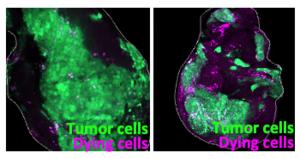 Blocking macrophages from eating dead cancer cells suppresses tumor growth in fruit flies