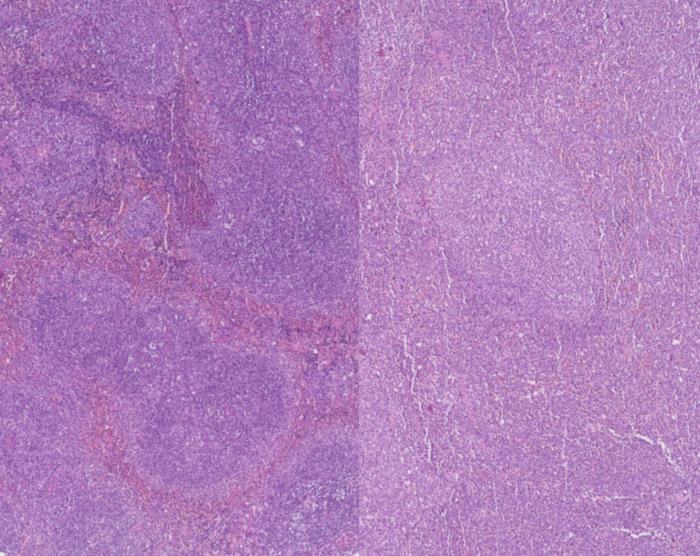 Image of tissues with and without PHF19