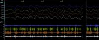 Electrophysiological Signals
