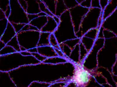 Neuron with Synapses
