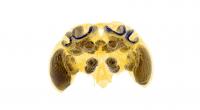 Brain scan