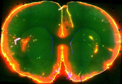 Sleep May Flush out the Brain