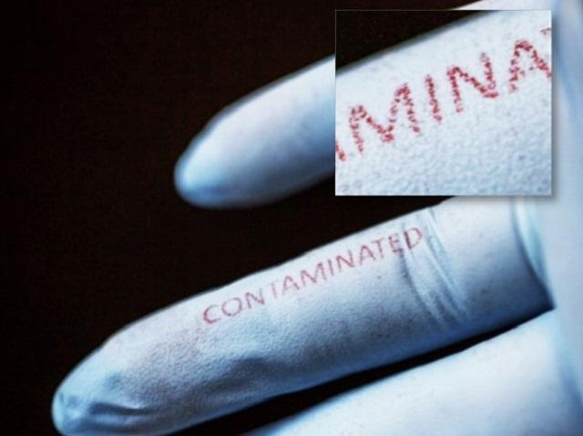 Biosensing Surgical Gloves