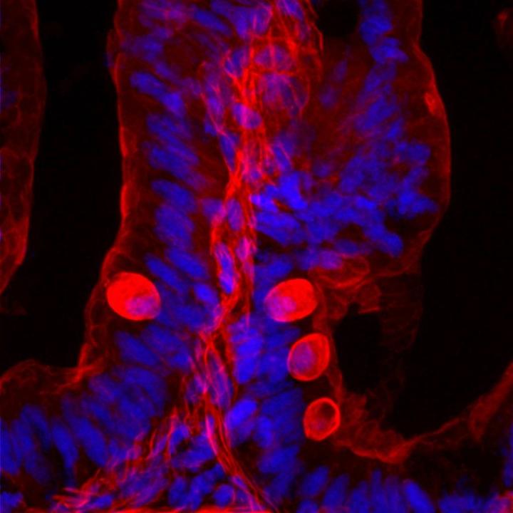 Epithelial Cells