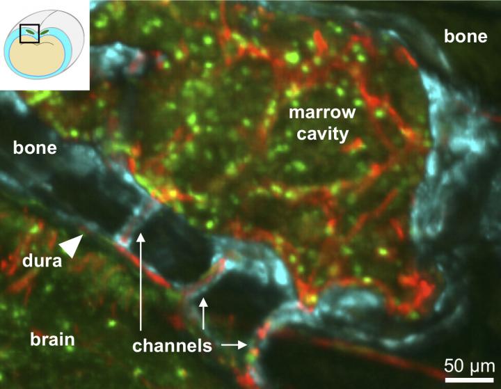 Microscopic Channels Connect Skull Bone Marrow to Outer Surface of Brain