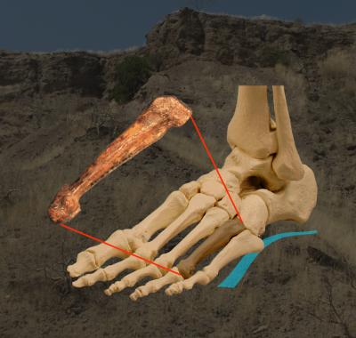 The Fourth Metatarsal/Photo Illustration