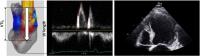 Measurement of E-Wave Propagation Index (EPI)