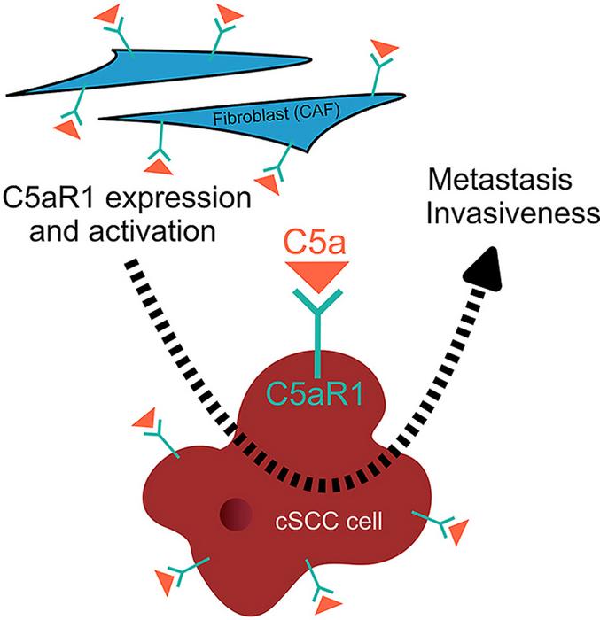 Study Links a Novel Biomarker with Potential to Predict and Treat Skin Cancer Metastasis