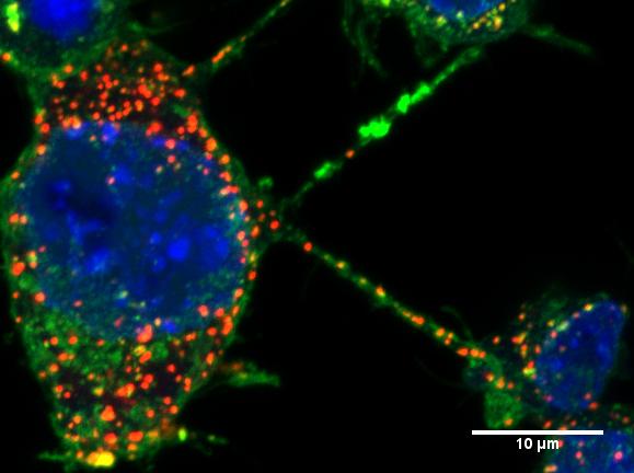 Neuronal Cells Connected by TNTs