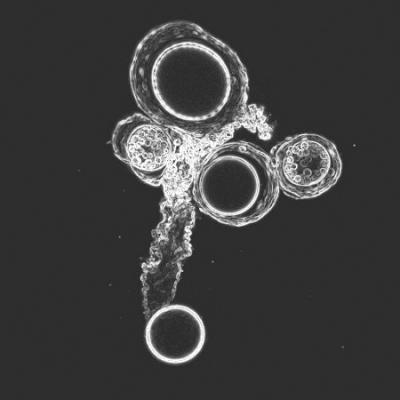 A Gene for the Amoeba's Sexual Fate (5 of 6)