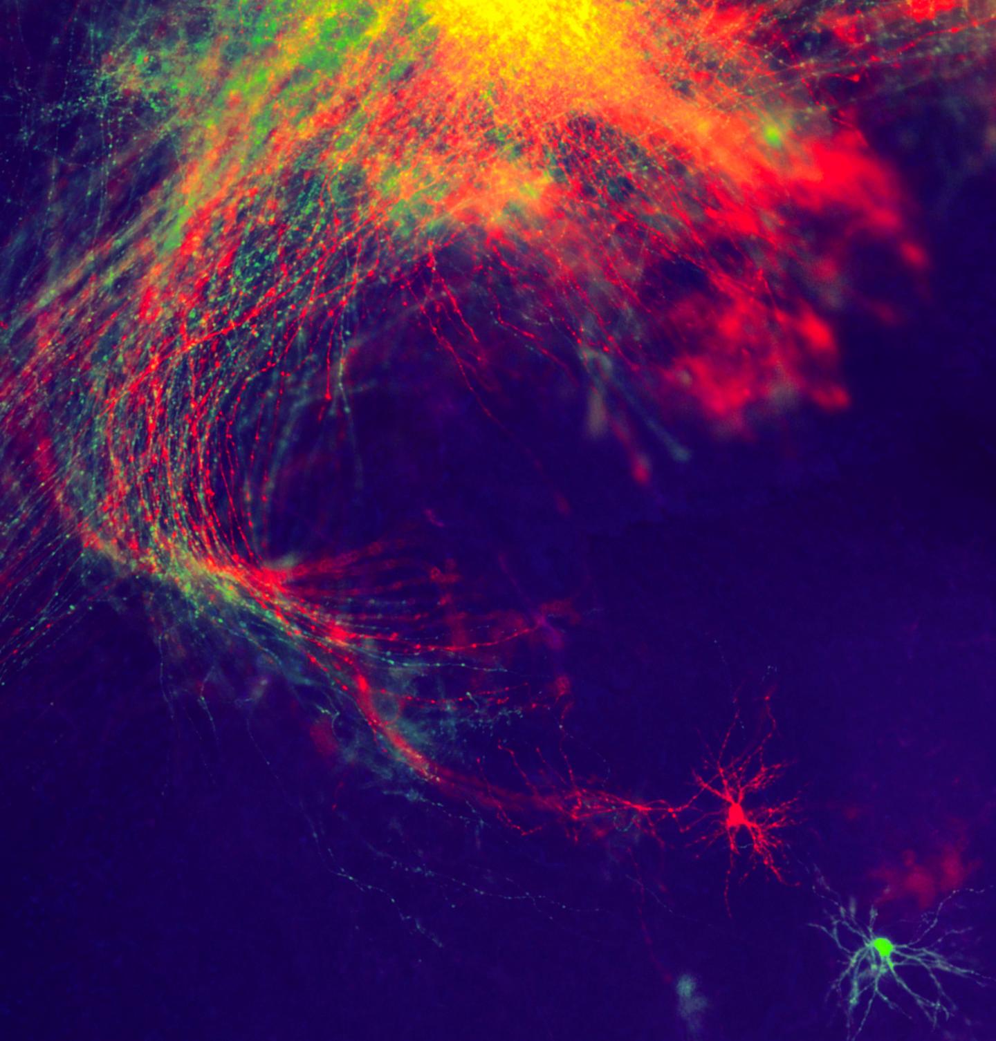 Scientists at the Salk Institute Discovered New Details into How Master Proteins Dictate Neuron's Sp