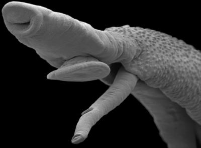 <i>Schistosoma mansoni</i> EM