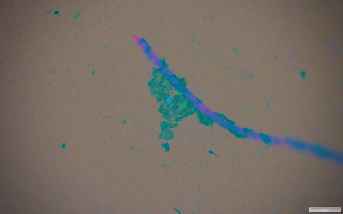 Microplastic pollution and pathogens under micropscope