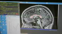 Shedding New Light on Learning Disorders
