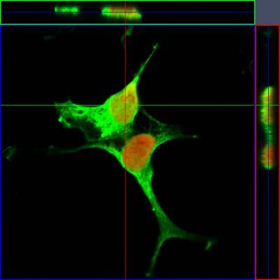 AIMP2 Interacts with PARP1