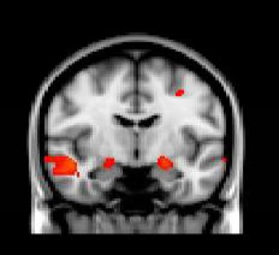 Brain Scan