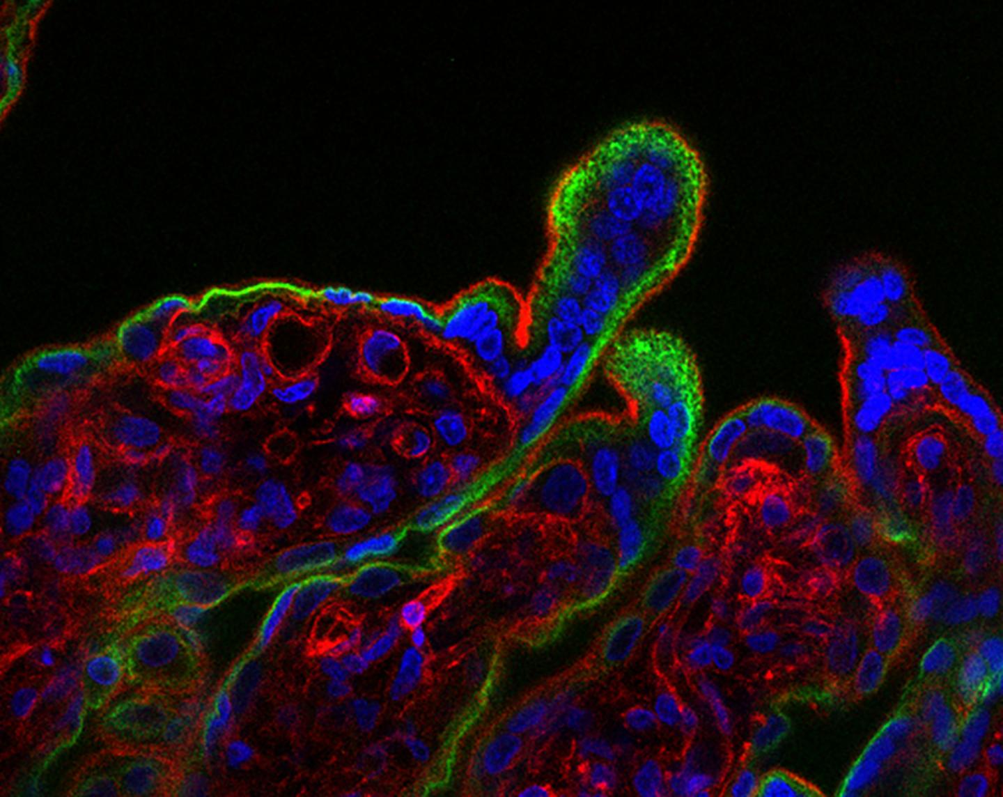 Placental Tissue
