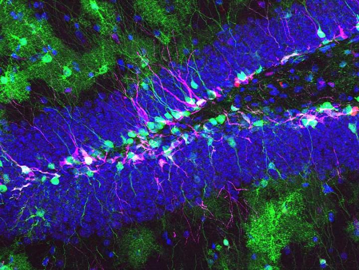 Neural Stem Cells