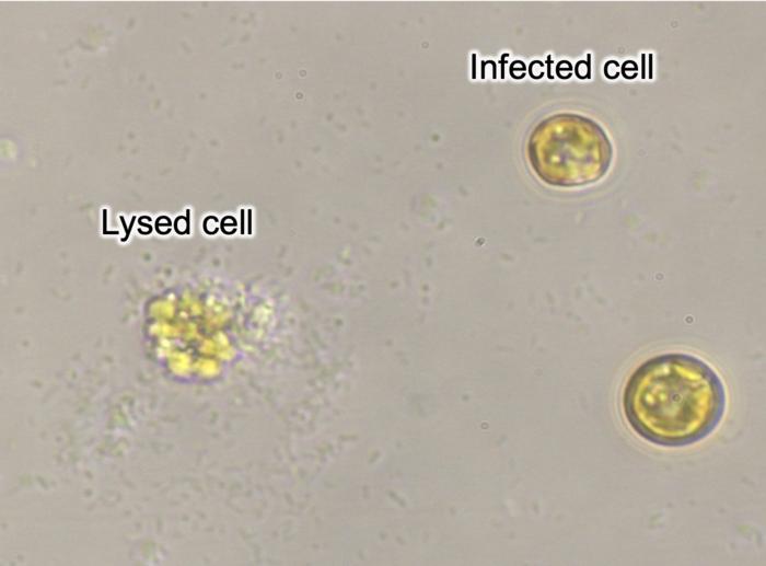 Phytoplankton cells