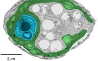 False-color Electron Microscopy Image Showing the Pyrenoid of a Green Algea