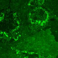 Toothpick: New Molecular Tag IDs Bone and Tooth Minerals (2 of 2)