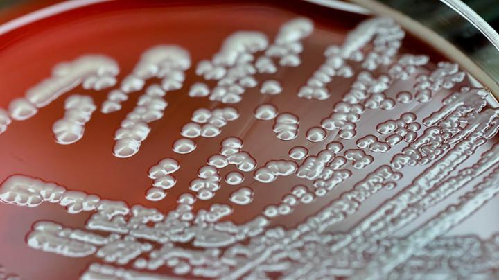 E. Coli in a Dish