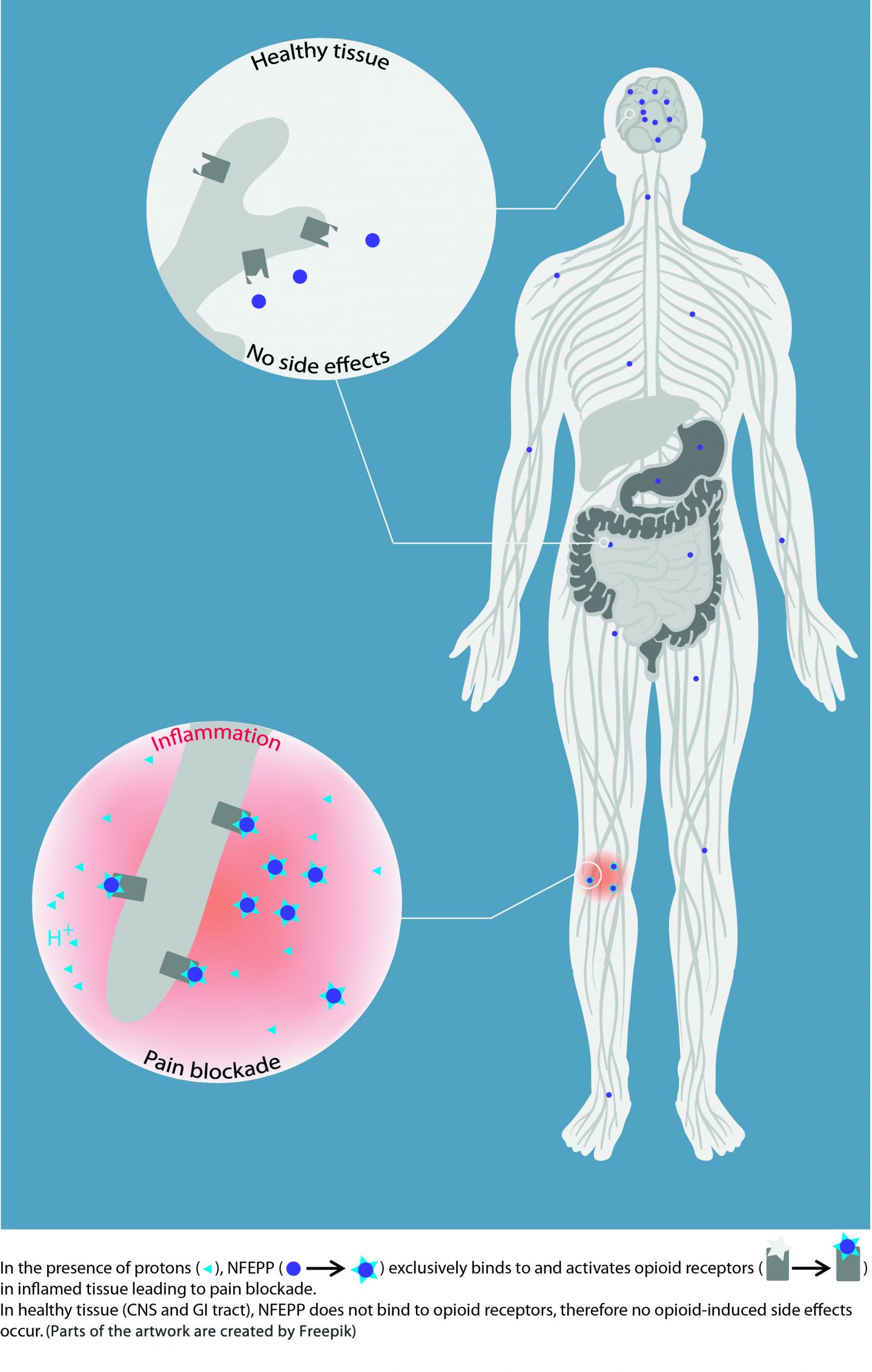 Pain Relief at the Site of Inflammation