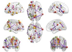 exercise brains