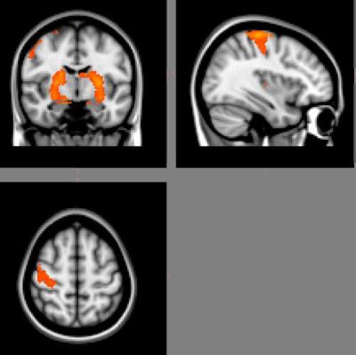 Fluid Low-cost Movements