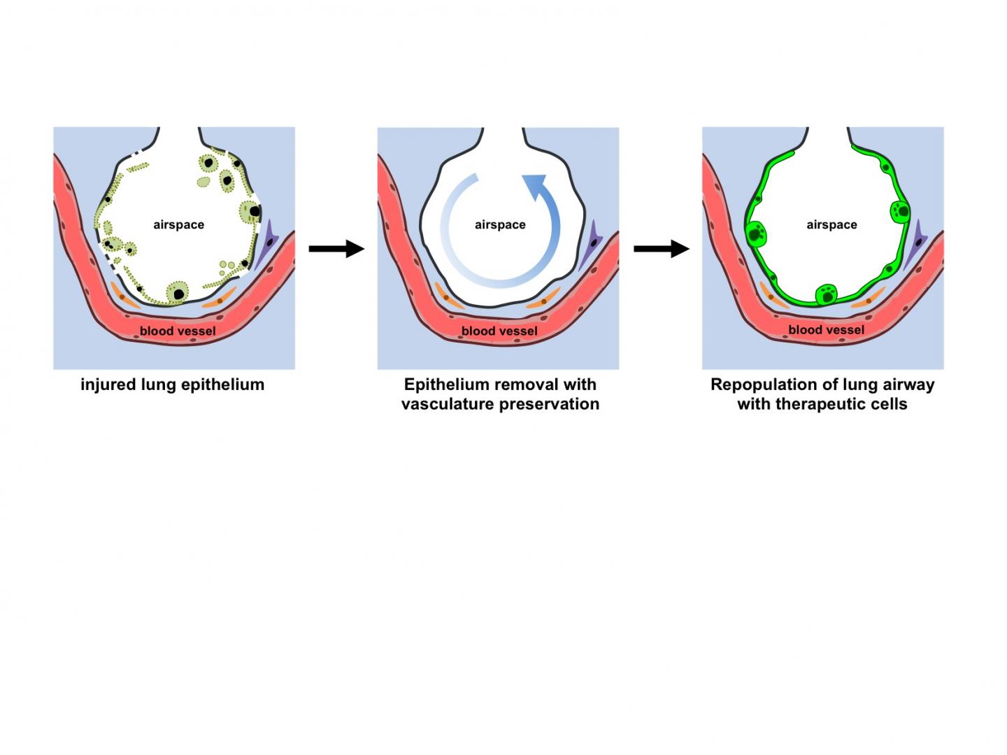 Functional Vascularized Graft for Lung Bioengineering 