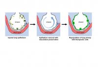 Functional Vascularized Graft for Lung Bioengineering 