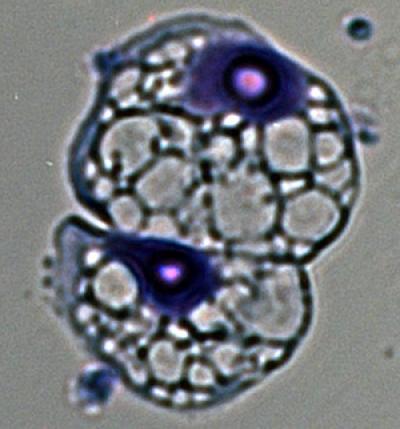Immune Cells May Heal an Injured Heart