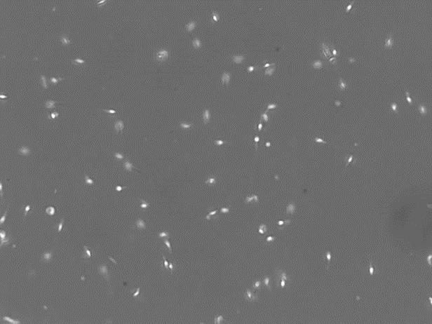 Human Sperm