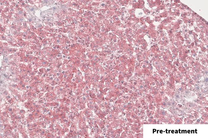 ZSD microscope images of mouse liver tissue.