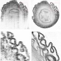OCRT Images of Van Deferens