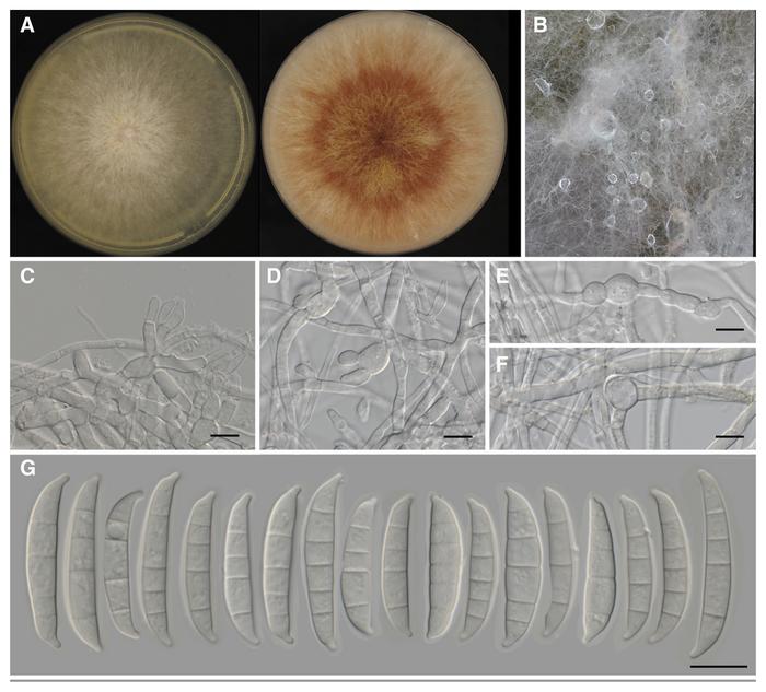 Macroscopic and microscopic images of Fusarium kistleri