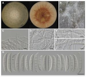 Macroscopic and microscopic images of Fusarium kistleri