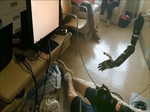 Prosthetic Arm Moves Individual 'fingers'