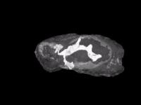 3-D MRM of Normal Mouse Brain