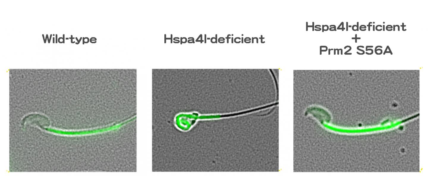 Development of Mature Sperm (1 of 2)