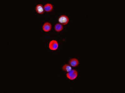 Circulating Tumor Cells